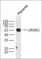 Zinc Finger CCCH-Type, RNA Binding Motif And Serine/Arginine Rich 2 antibody, orb186521, Biorbyt, Western Blot image 
