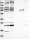 Zinc Finger CCHC-Type Containing 7 antibody, NBP1-89177, Novus Biologicals, Western Blot image 