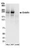 Zinc Finger FYVE-Type Containing 16 antibody, A304-574A, Bethyl Labs, Western Blot image 