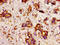 ASE-1 antibody, LS-C672546, Lifespan Biosciences, Immunohistochemistry paraffin image 