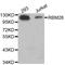 RNA Binding Motif Protein 26 antibody, STJ27793, St John