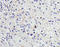 C-C Motif Chemokine Receptor 3 antibody, LS-C202988, Lifespan Biosciences, Immunohistochemistry frozen image 