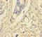 Phosphoinositide-3-Kinase Regulatory Subunit 5 antibody, A51105-100, Epigentek, Immunohistochemistry paraffin image 