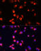 Bone Morphogenetic Protein Receptor Type 1B antibody, 18-442, ProSci, Immunofluorescence image 