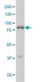 Receptor-interacting serine/threonine-protein kinase 4 antibody, H00054101-M01, Novus Biologicals, Western Blot image 