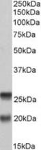 Synaptosome Associated Protein 23 antibody, LS-C139614, Lifespan Biosciences, Western Blot image 