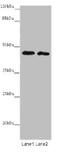 BTB Domain Containing 2 antibody, A53993-100, Epigentek, Western Blot image 
