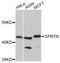 SprT-Like N-Terminal Domain antibody, A06028, Boster Biological Technology, Western Blot image 