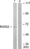 Dihydropyrimidinase Like 2 antibody, TA313767, Origene, Western Blot image 