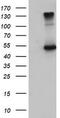 EGF Containing Fibulin Extracellular Matrix Protein 1 antibody, M02302, Boster Biological Technology, Western Blot image 