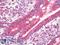CXADR Ig-Like Cell Adhesion Molecule antibody, LS-B8702, Lifespan Biosciences, Immunohistochemistry frozen image 
