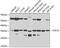 Serine/threonine-protein kinase 19 antibody, GTX32901, GeneTex, Western Blot image 