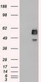 Small RNA Binding Exonuclease Protection Factor La antibody, TA500436, Origene, Western Blot image 