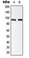 Catenin Beta 1 antibody, MBS827184, MyBioSource, Western Blot image 