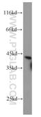 Retinol Dehydrogenase 10 antibody, 14644-1-AP, Proteintech Group, Western Blot image 