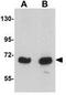Kelch-like protein 15 antibody, GTX85275, GeneTex, Western Blot image 