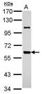 UDP-N-acetylhexosamine pyrophosphorylase antibody, GTX118446, GeneTex, Western Blot image 