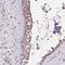 Kelch Like Family Member 11 antibody, HPA054269, Atlas Antibodies, Immunohistochemistry paraffin image 