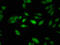 NCOR1 antibody, LS-C672678, Lifespan Biosciences, Immunofluorescence image 
