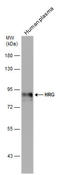 Histidine-rich glycoprotein antibody, GTX131514, GeneTex, Western Blot image 