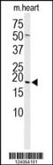 Heat shock protein beta-6 antibody, 64-037, ProSci, Western Blot image 