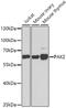 P21 (RAC1) Activated Kinase 2 antibody, GTX65807, GeneTex, Western Blot image 