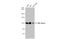 DNA Ligase 1 antibody, GTX70141, GeneTex, Western Blot image 