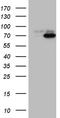 Phosphoinositide Kinase, FYVE-Type Zinc Finger Containing antibody, TA810373, Origene, Western Blot image 