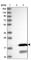 Chromosome 11 Open Reading Frame 52 antibody, HPA038388, Atlas Antibodies, Western Blot image 