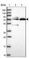 Solute Carrier Family 28 Member 2 antibody, NBP2-33451, Novus Biologicals, Western Blot image 