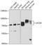 Luteinizing Hormone/Choriogonadotropin Receptor antibody, GTX64387, GeneTex, Western Blot image 