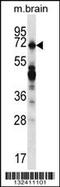 POB1 antibody, 56-869, ProSci, Western Blot image 