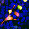 mCherry Tag  antibody, LS-C204827, Lifespan Biosciences, Immunocytochemistry image 