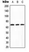 Protein Phosphatase 2 Scaffold Subunit Abeta antibody, GTX55165, GeneTex, Western Blot image 