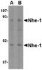 Solute Carrier Family 9 Member A1 antibody, PA5-20446, Invitrogen Antibodies, Western Blot image 