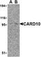 Caspase Recruitment Domain Family Member 10 antibody, TA306097, Origene, Western Blot image 