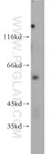 RAC-gamma serine/threonine-protein kinase antibody, 21641-1-AP, Proteintech Group, Western Blot image 