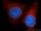 VAMP Associated Protein B And C antibody, 14477-1-AP, Proteintech Group, Immunofluorescence image 
