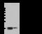 Myosin regulatory light chain 2, ventricular/cardiac muscle isoform antibody, 107496-T40, Sino Biological, Western Blot image 