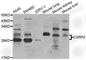 Cysteine And Glycine Rich Protein 2 antibody, A7549, ABclonal Technology, Western Blot image 