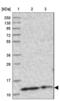 Coiled-Coil-Helix-Coiled-Coil-Helix Domain Containing 5 antibody, NBP1-86796, Novus Biologicals, Western Blot image 