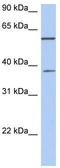 Nucleoporin 43 antibody, TA333343, Origene, Western Blot image 