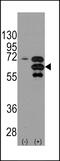 Internexin Neuronal Intermediate Filament Protein Alpha antibody, 62-218, ProSci, Western Blot image 