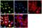Ubiquitin Specific Peptidase 7 antibody, PA5-17179, Invitrogen Antibodies, Immunofluorescence image 