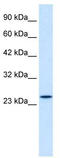 Zinc Finger Protein 22 antibody, TA338119, Origene, Western Blot image 