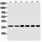 Sonic Hedgehog Signaling Molecule antibody, orb146711, Biorbyt, Western Blot image 