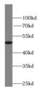 Mitogen-Activated Protein Kinase 8 antibody, FNab04447, FineTest, Western Blot image 