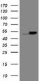 Epoxide Hydrolase 1 antibody, M00899-1, Boster Biological Technology, Western Blot image 