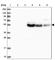 Solute Carrier Family 2 Member 10 antibody, HPA041015, Atlas Antibodies, Western Blot image 