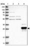 Zinc Finger Protein 397 antibody, NBP1-82753, Novus Biologicals, Western Blot image 